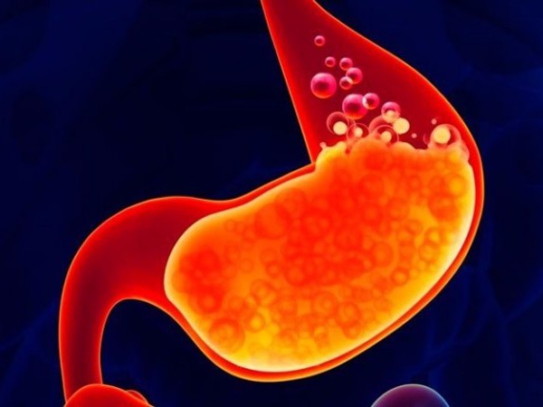 ដំណោះស្រាយបញ្ហាដែលជួបប្រទះញឹកញាប់នៅនឹងពោះ