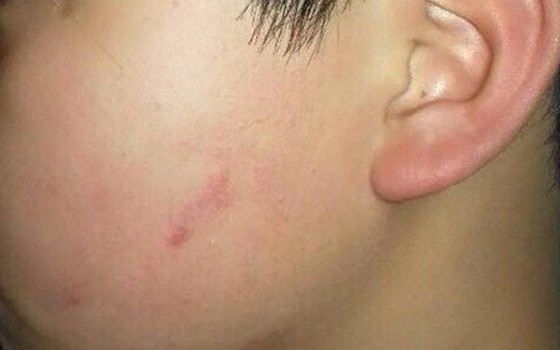 Chủ tịch Hà Nội yêu cầu xử lý cô giáo cho 40 học sinh tát bạn