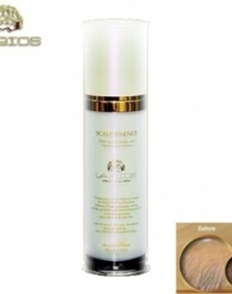 THUỐC MỌC TÓC VÀ NGĂN RỤNG TÓC LABIOS SCALP ESSENCE 60ML 