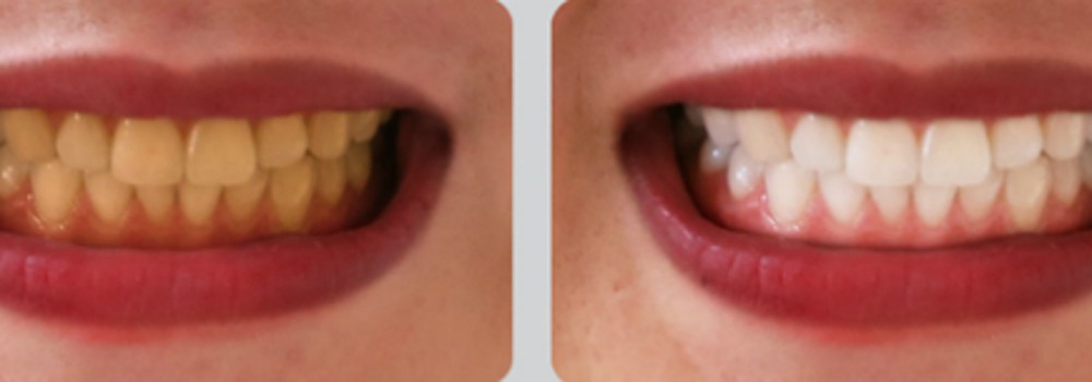 Đón năm mới may mắn với nụ cười rạng rỡ