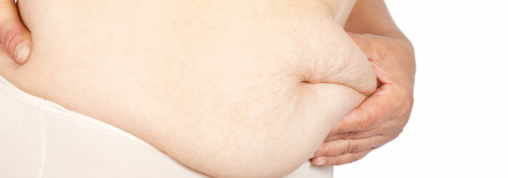 Thoát khỏi 'cơn ác mộng' mỡ bụng dưới