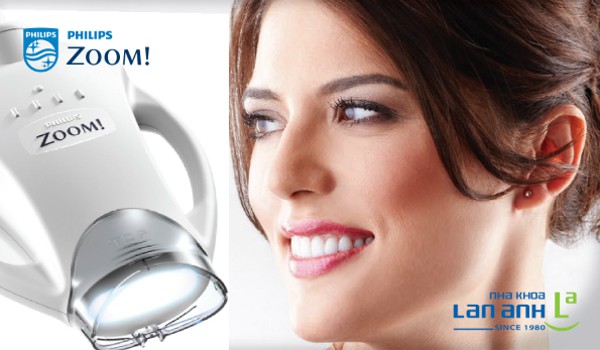 Tẩy trắng răng với hệ thống Zoom White Speed của Mỹ