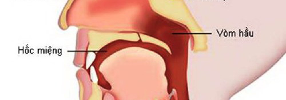 Cách nhận biết sớm các loại ung thư đầu cổ