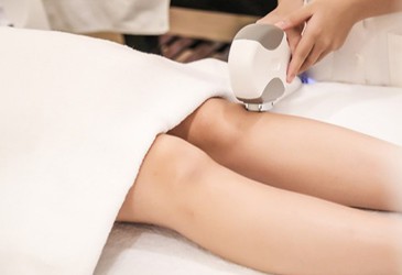 Triệt lông vĩnh viễn