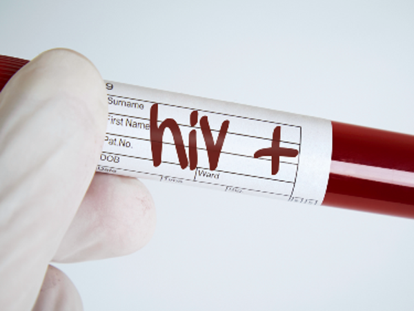 Sắp có văcxin trị HIV