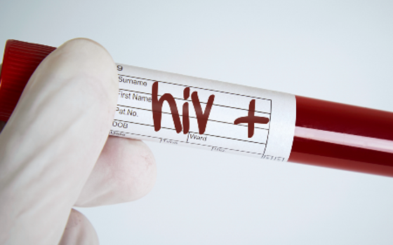 Sắp có văcxin trị HIV