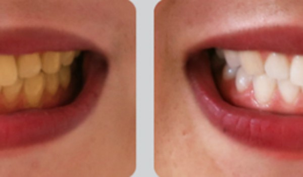 Đón năm mới may mắn với nụ cười rạng rỡ