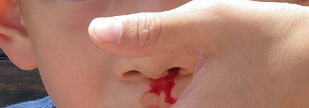 Dấu hiệu nhận biết sớm bạn bị ung thư máu