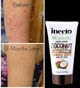 Coconut Body Scrub – Inecto