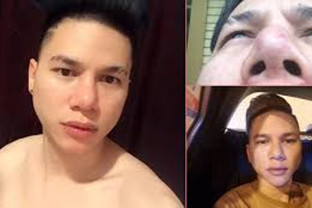 Sao Việt với phẫu thuật thẩm mỹ: Không phải lúc nào cũng đẹp như ý!