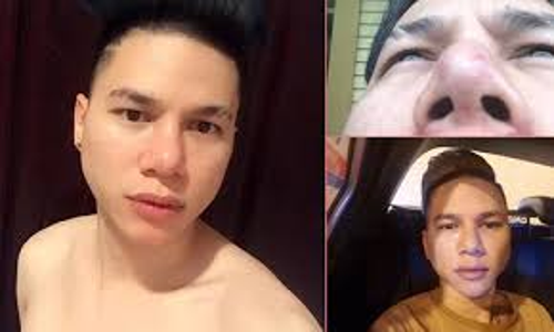 Sao Việt với phẫu thuật thẩm mỹ: Không phải lúc nào cũng đẹp như ý!