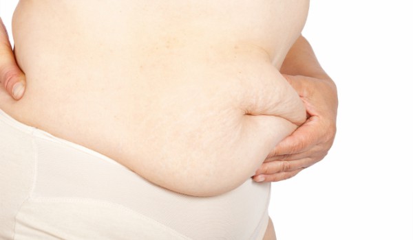 Thoát khỏi 'cơn ác mộng' mỡ bụng dưới